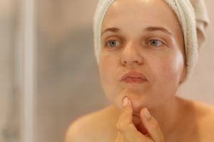 Як боротись з розширеними порами